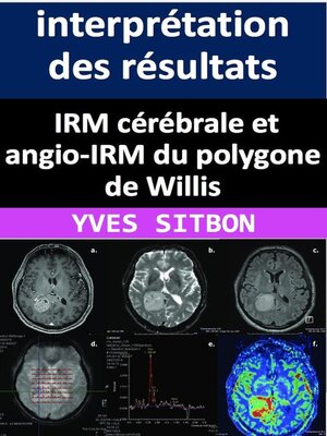 cover image of IRM cérébrale et angio-IRM du polygone de Willis
